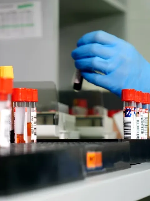 Tubos de exames laboratoriais em análise